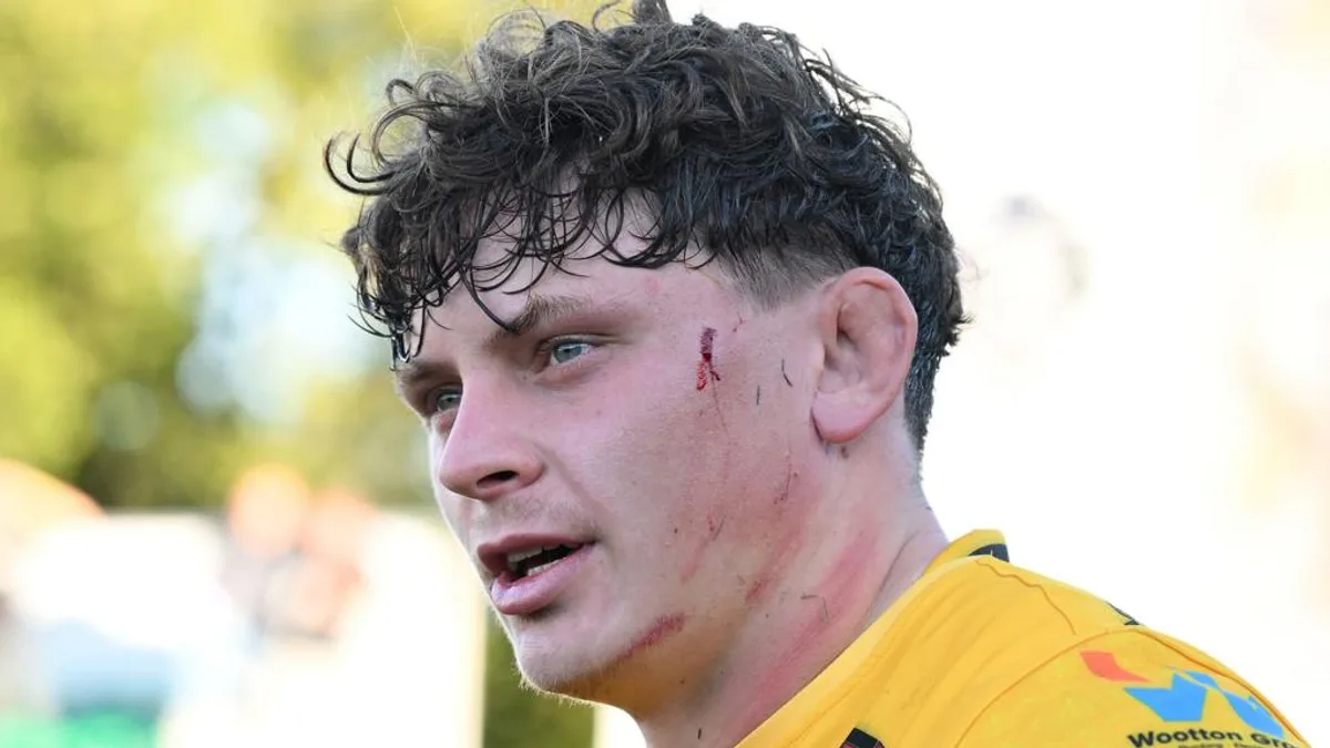 Dragons Suffer Woodman Blow With Bicep Injury Until December